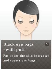 Black eye bags ? with puff 